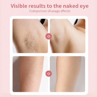 ENIA NOVA™ 3 in 1 Precision Hair Removal System
